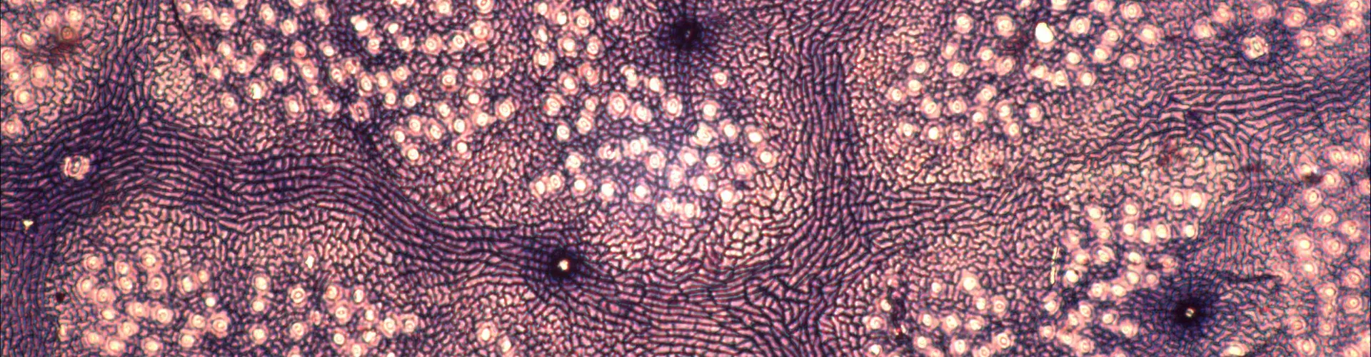 A Foulden fossil leaf magnified 400x. (Credit: Tammo Reichgelt/University of Connecticut)